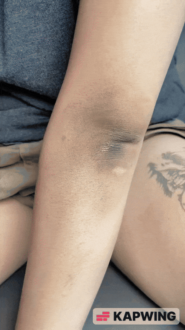 Knees & Elbows