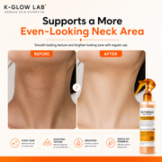 Dr.Melaxin® Peel Shot (BUY 1  GET 1 FREE)| Exfoliating Kojic Acid Turmeric Spray 200ml